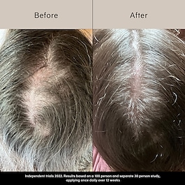 Pitta Growth Serum - Wachstumsserum